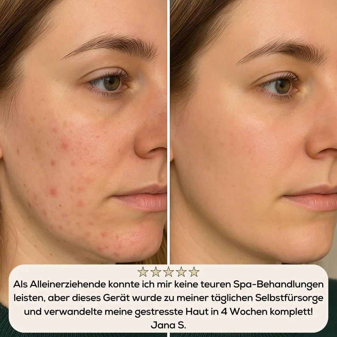 GlowLift Pro