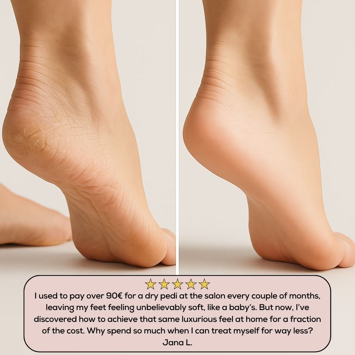 SilkyStep Pro
