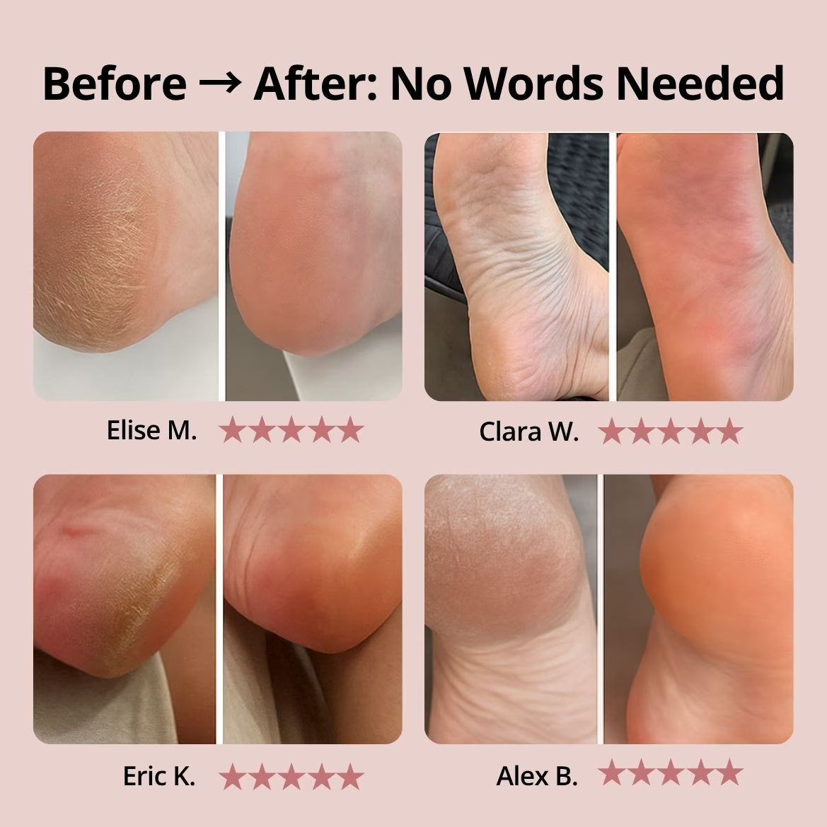 SilkyStep Pro