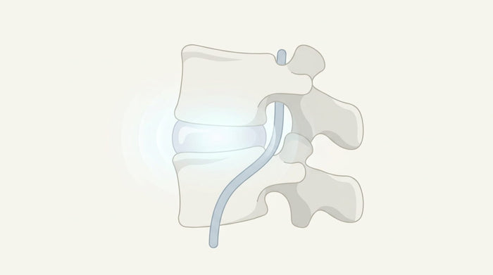 Mechanical Separation