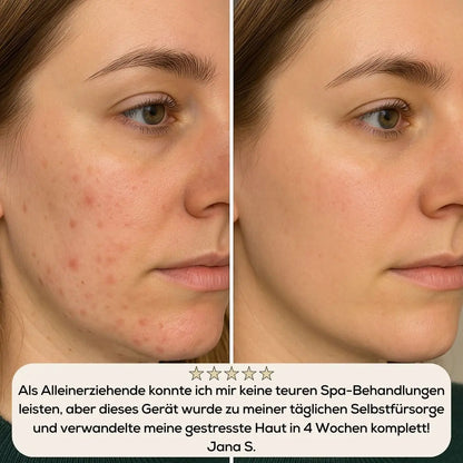 GlowLift Pro