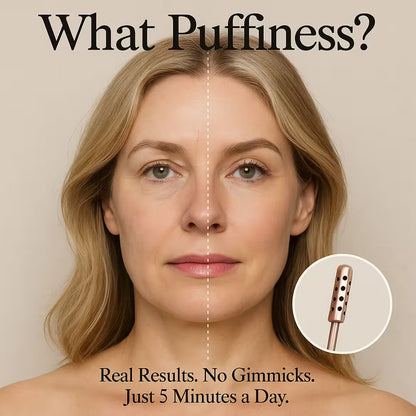 LiftLuxe Face Roller