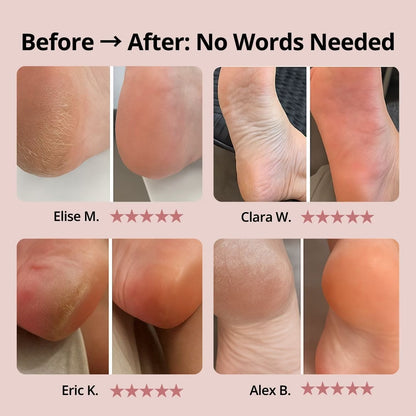 SilkyStep Pro